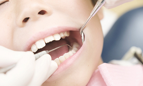 小児歯科 イメージ